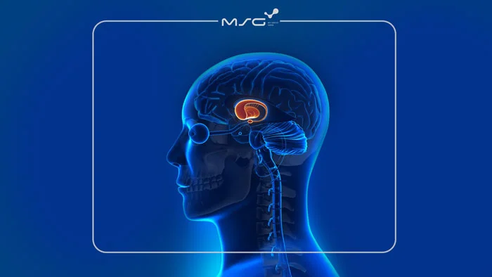 بیماری هانتینگتون